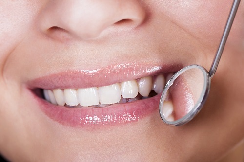 Surgical Options You Have to Restore Lost Gum Tissue