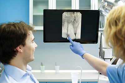 What Are Panoramic Dental X-Rays?