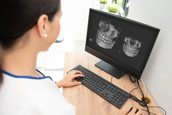 Dental professional analyzing 3D X-rays of a patient's full-mouth restoration progress on a computer screen.